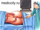 Проктит: что следует о нем знать?